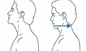 Chin Tuck | Sakit Kepala Belakang | Tarik Dagup