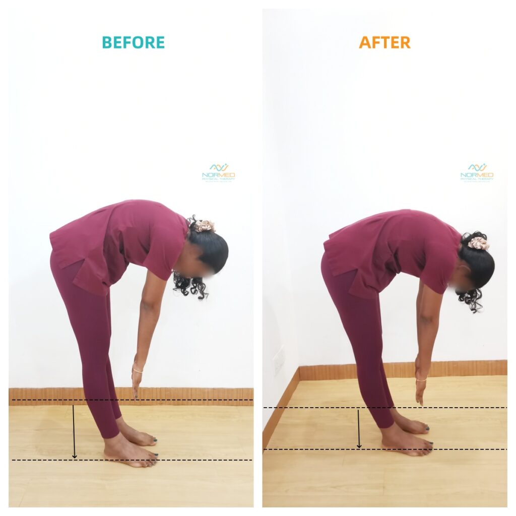 Improvement of client in bending forward after posture fit group class.