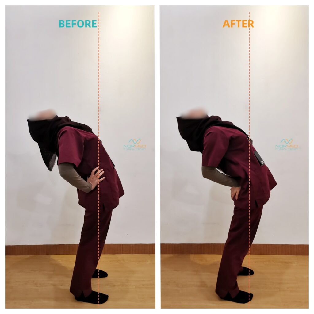 Improvement of client in bending backward after posture fit group class.