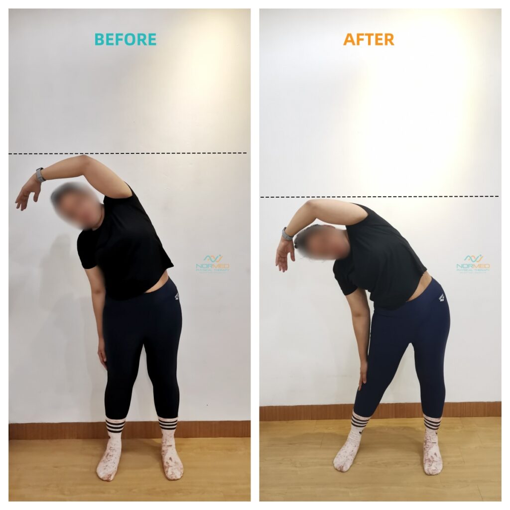 Improvement of client in bending to the right after posture fit group class.